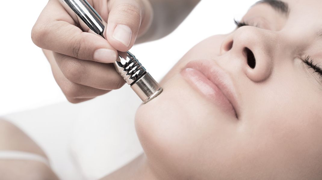 The skin concerns that will benefit from a Microdermabrasion