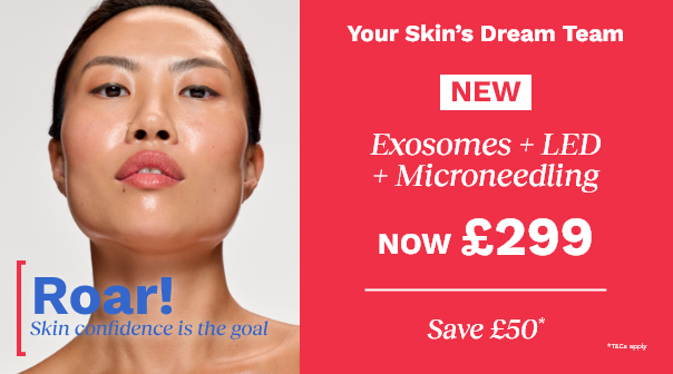 Save £50 on the NEW Exosomes + Microneedling + Yellow LED Treatment*