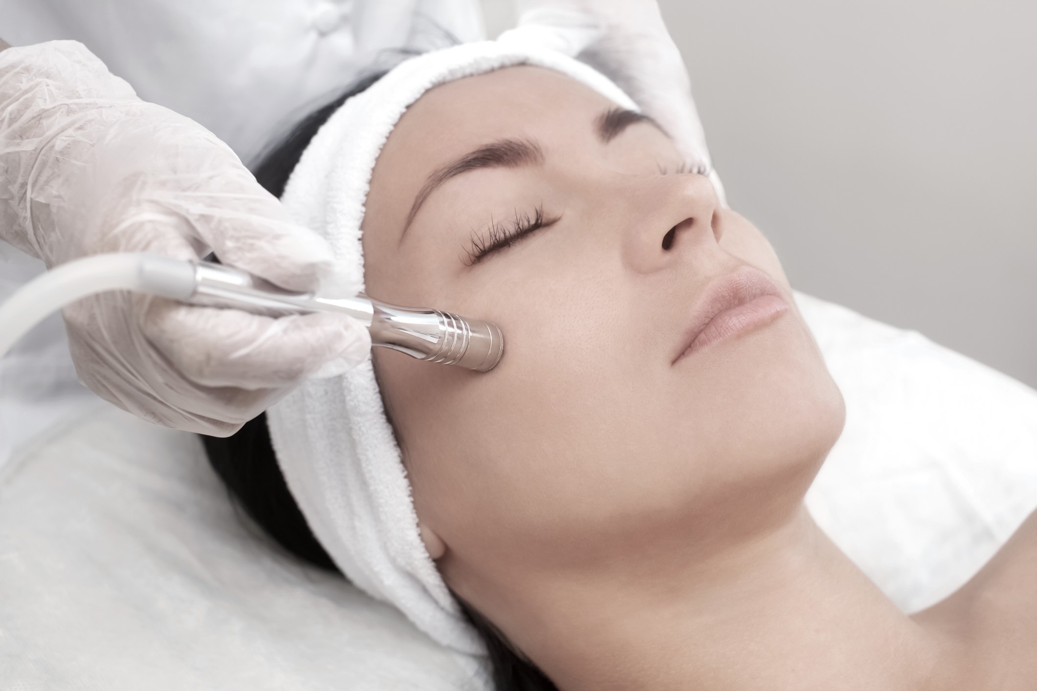 Everything you need to know about the 5-Step Microdermabrasion