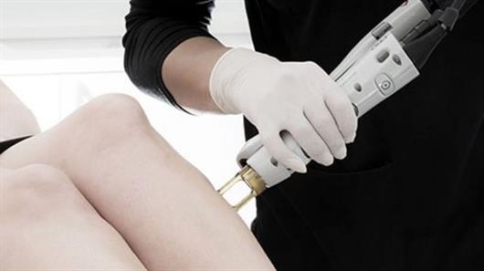 Popular laser hair removal treatments for men and women